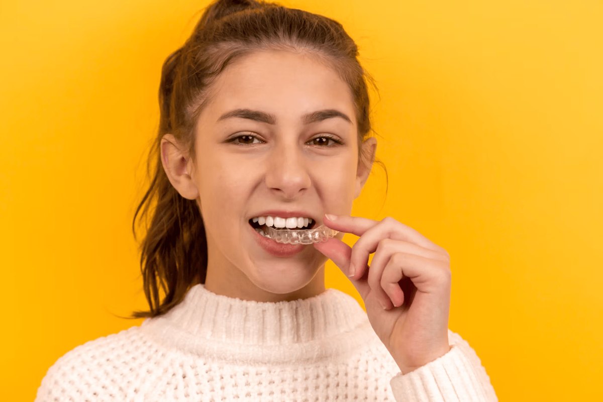 Young woman placing a clear aligner tray